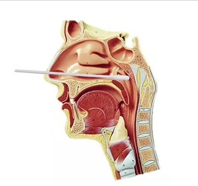 鼻拭子采样图图片