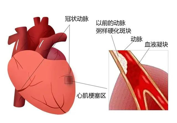 图片 2.jpg