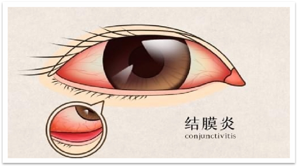 图片 2.jpg